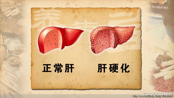 肝硬化和正常肝脏对比如下图